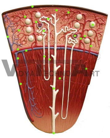 Renal Pyramid